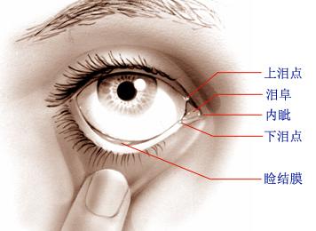 专家教您如何战胜干眼症?