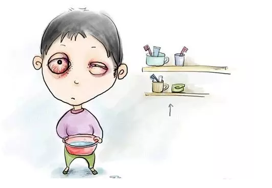 夏季是"红眼病"高发的季节,红眼病也叫急性结膜炎,是一种接触性