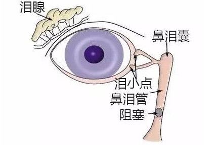 用拇指或十指指腹压迫泪囊,按在鼻根及眼睛的内眦中央的部位